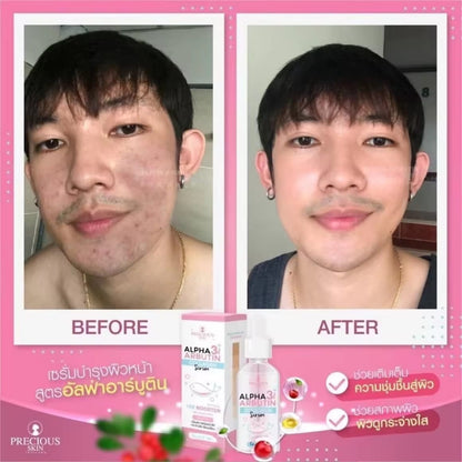 Alpha Arbutin 3+ Plus Collagen Whitening Facial Serum 50ml